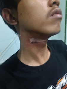 Kabel PLN Dibiarkan Terjuntai Rendah di Jalan Akibatkan Pemuda Tersangkut dan Luka Parah, PLN Blitar Harus Bertanggung Jawab